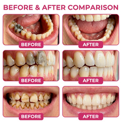 TERVENCE before and after comparison