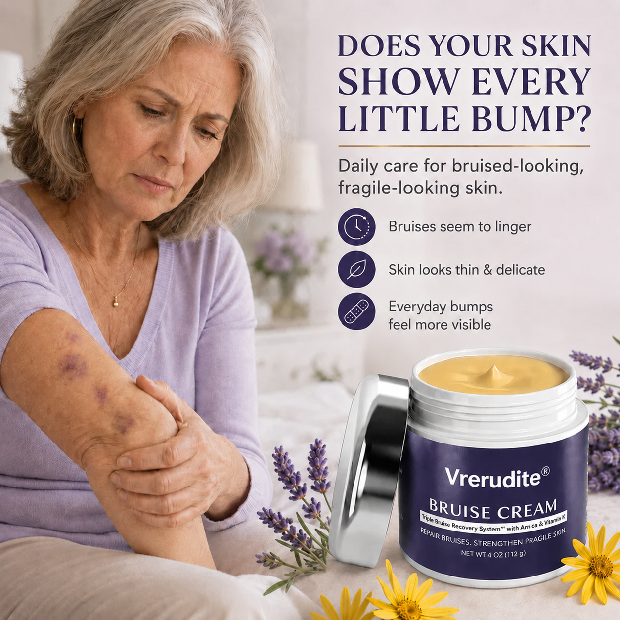 💥100K+ SOLD💕- Vrerudite® Bruise Repair & Skin-Strengthening Cream
